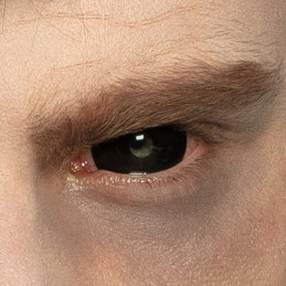 Lentilles Sclera 6 mois...